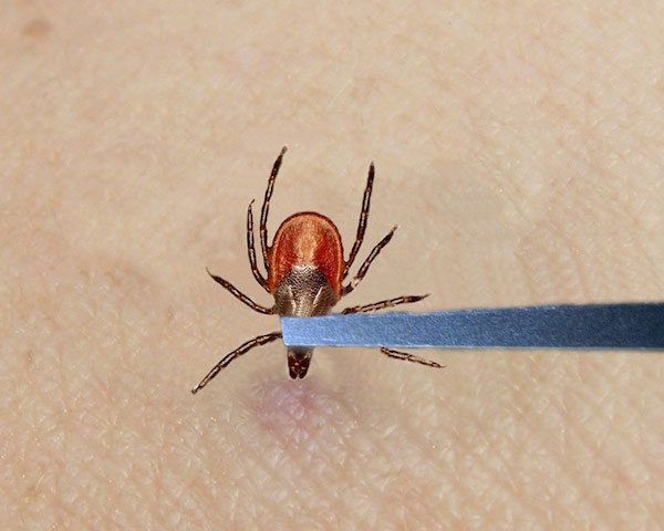 Tick-Removal-3
