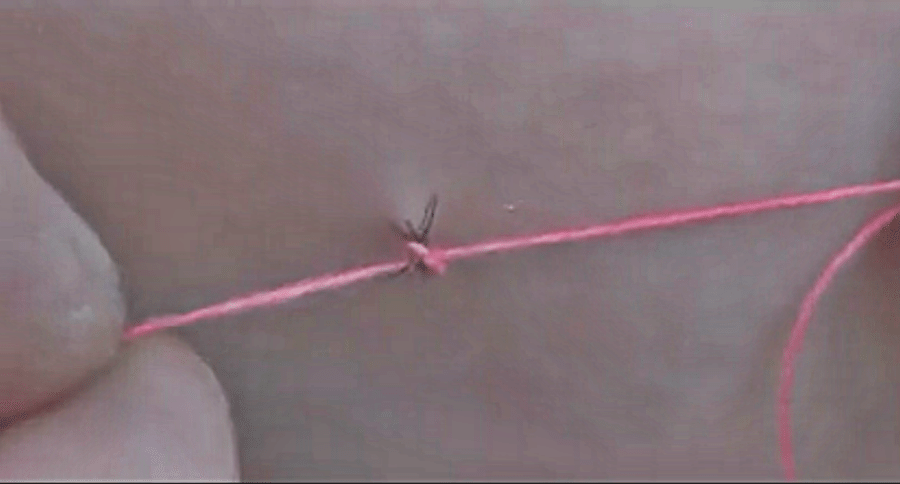 tick