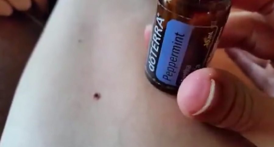 peppermint oil will remove a tick