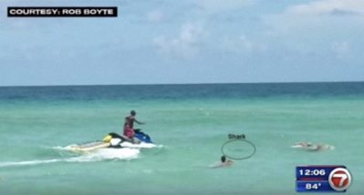 Shark Bites Swimmer's Legs at Popular Nude Beach Near Miami - Wide Open