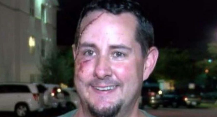 This Florida Man Lost A Boxing Match With A Bear And Lived To Tell The Tale