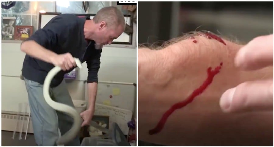 snake bite