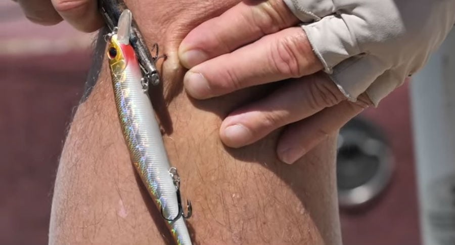 Hook Removal