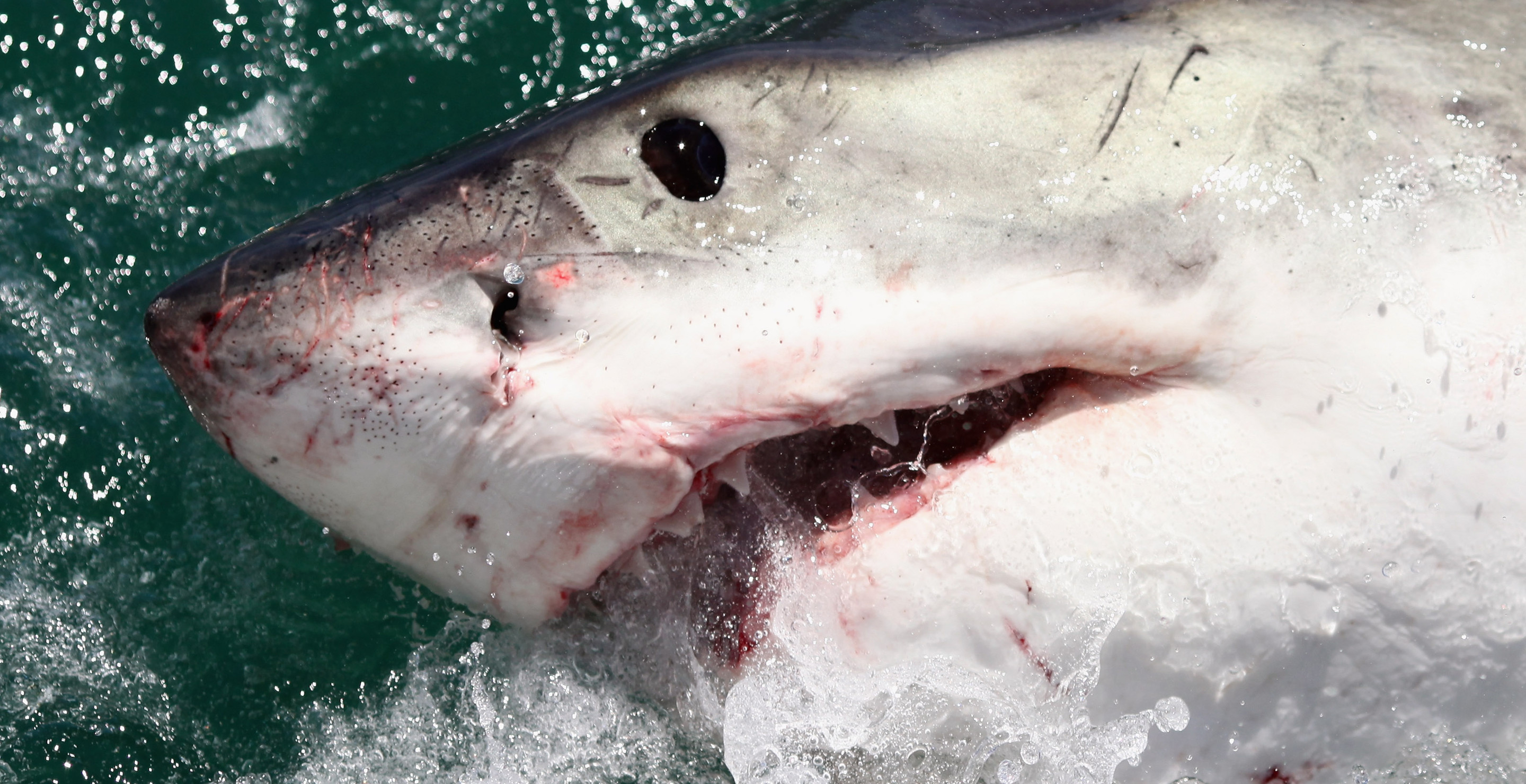 Mother Of Teen, Who Lost Leg And Hand, Details Horrific Shark Attack