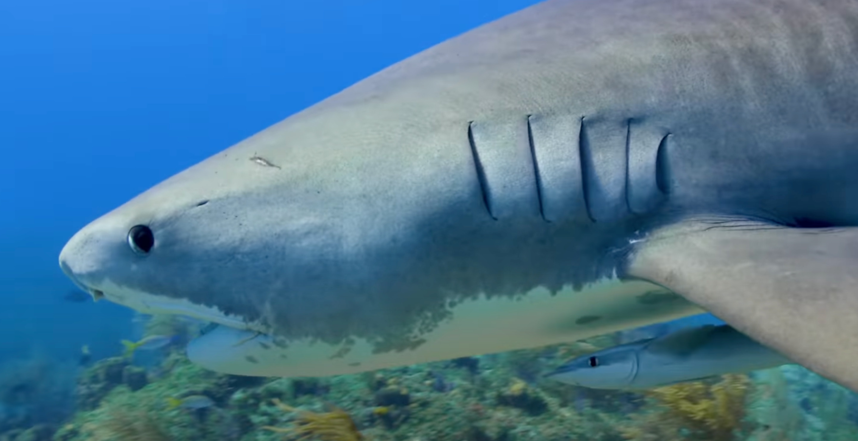 Oklahoma Teen Fights For His Life After Shark Bites His Arm
