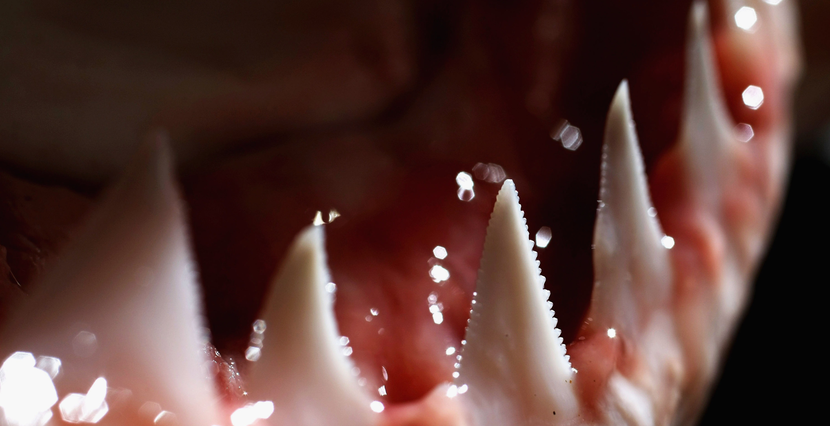 Vacationing Doctor Saves Young Girl's Life After Shark Attack