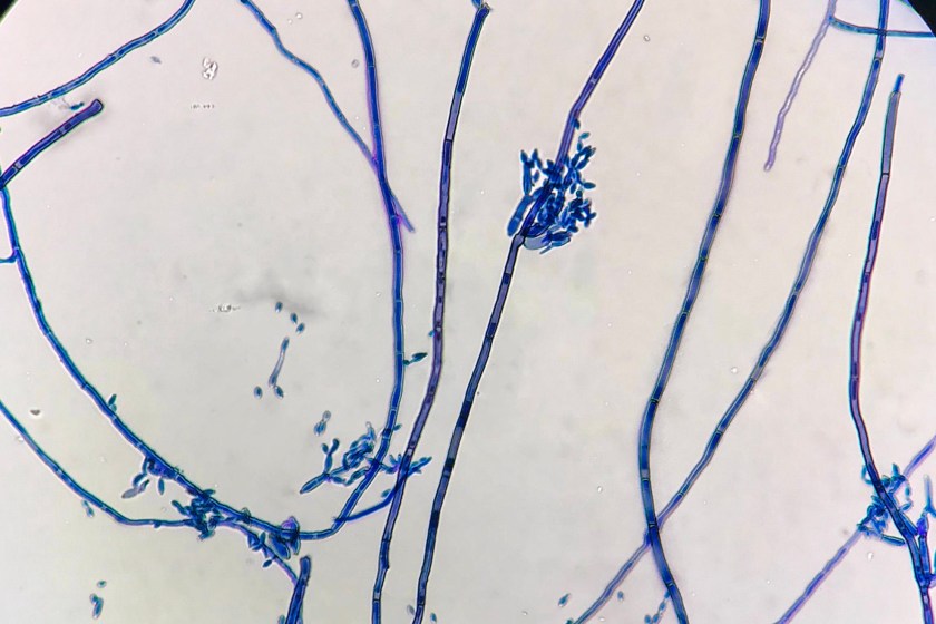 Fungus that mutates because of radiation at Chernobyl