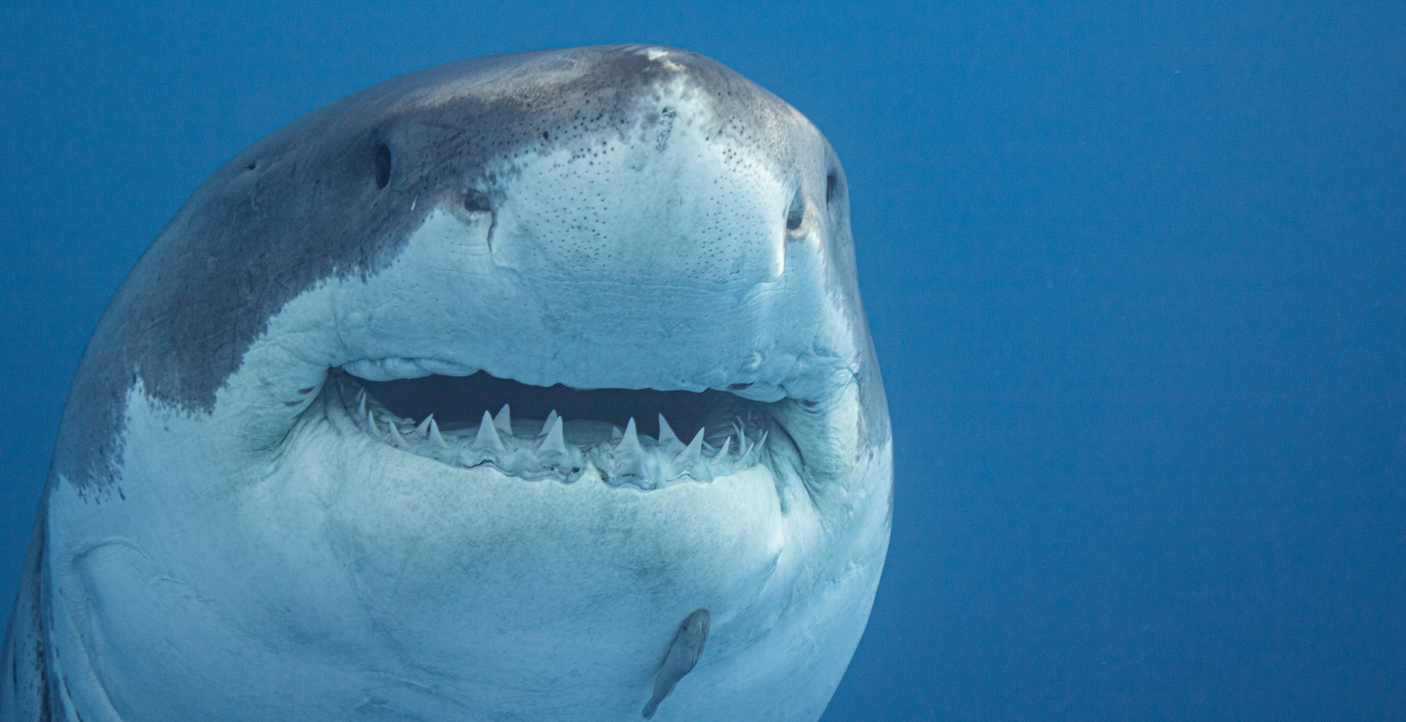 New York Man Has Face Reconstructed After Shark Bites Off Nose
