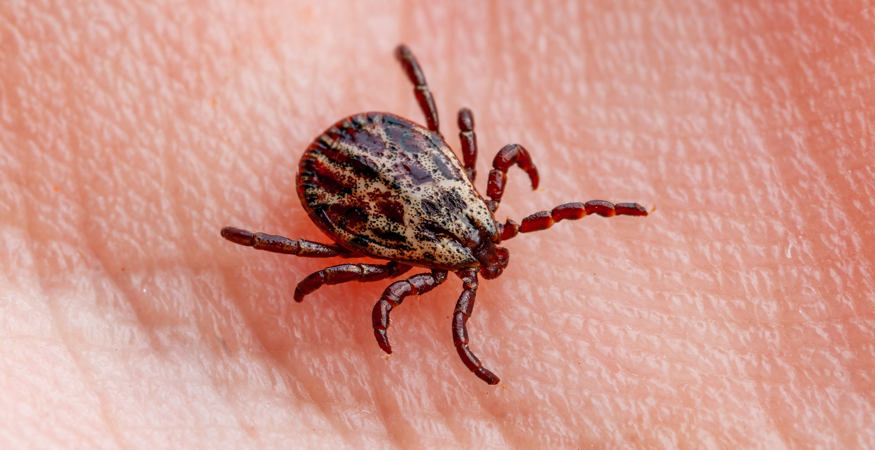 Fitness Influencer Left Partially Paralyzed After Getting Bit By A Tick