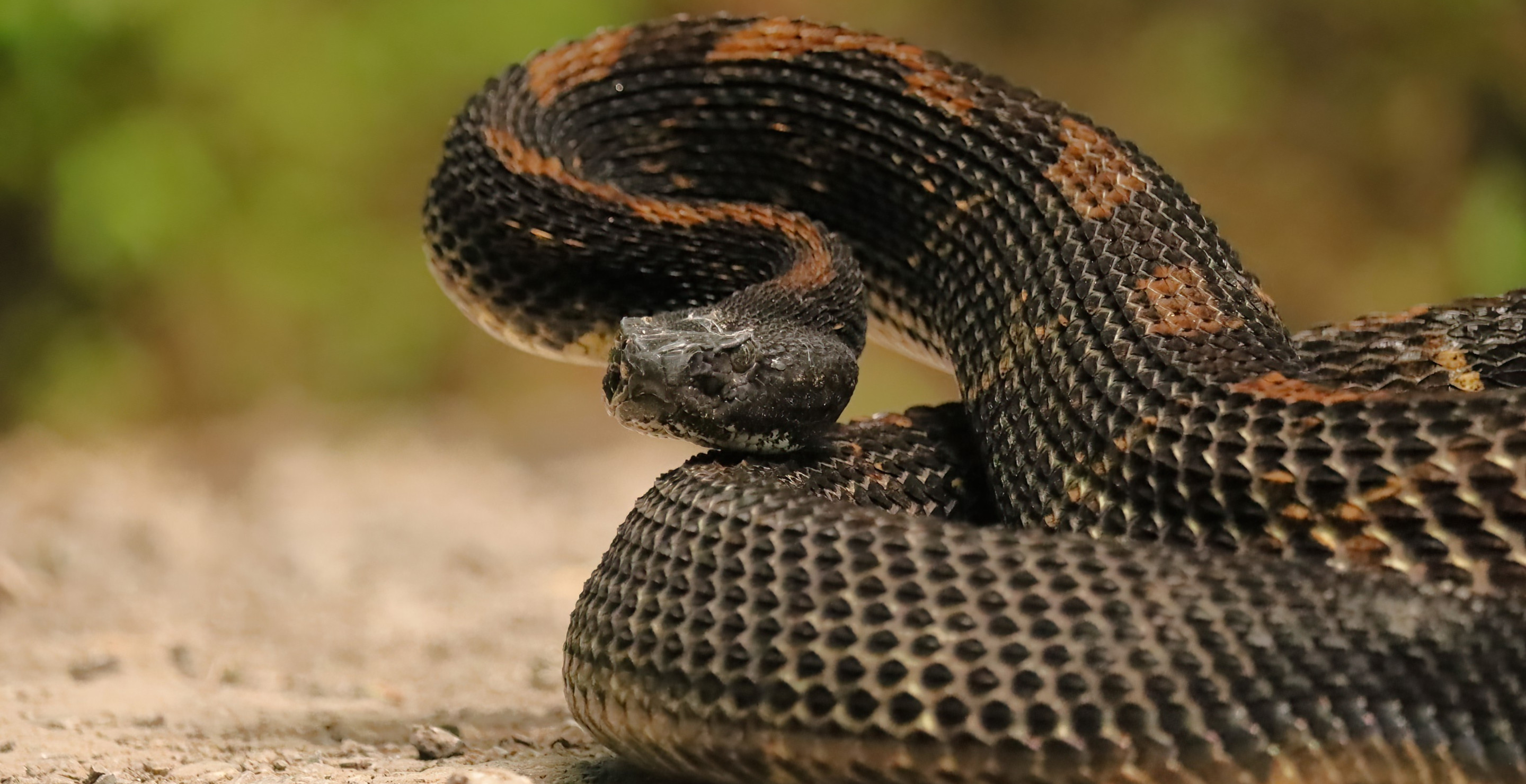 Teen Luckily To Be Alive After Rattlesnake Sinks Its Fangs Into His Leg While He Was Fishing With Friend